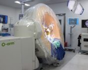 cirugía de Parkinson