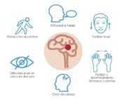 Accidente Cerebro Vascular