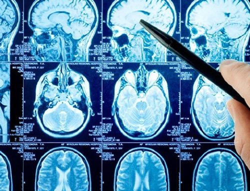 Abordaje integral de las urgencias neurológicas: Claves del V Simposio de Residentes de Neurología